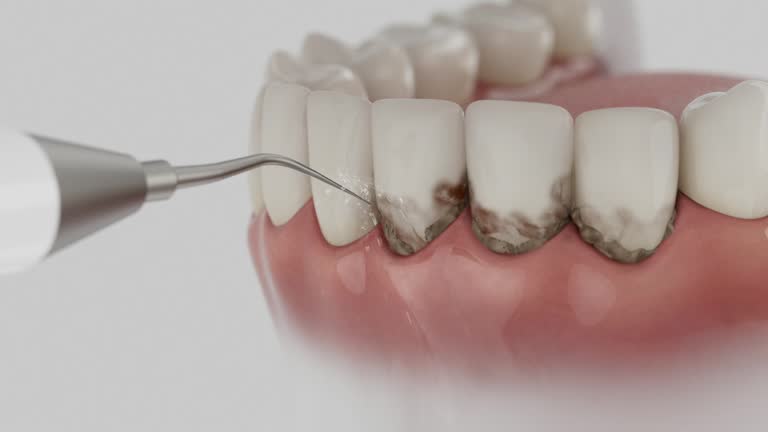 Reliable Emergency Dentist contractor in Clearfield, UT by Smile Center Dentistry